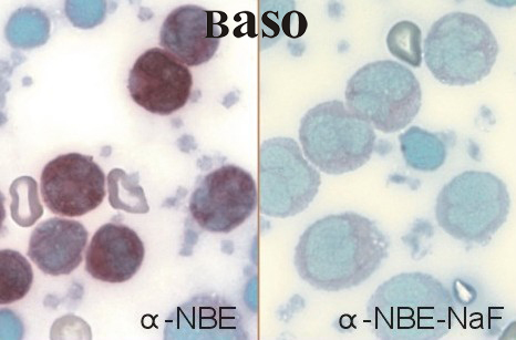 ��-����������øȾɫҺ(��-NBE)