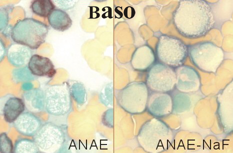 ���ԧ�-����������øȾҺ(ANAE)