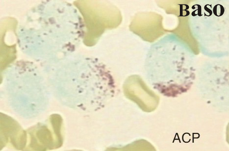 ��������øȾɫҺ��ACP��