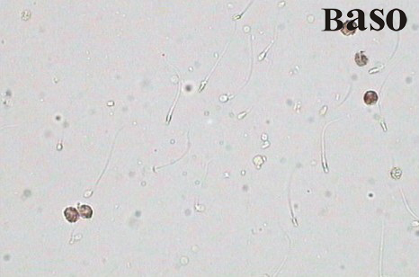 ��Һ�׼�(x��)���^(gu��)������øȾɫԇ���У����ױ�������